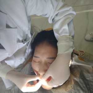 黔西南兴义京州口腔医院医生徐勇做牙贴面怎么样？附案例效果对比图