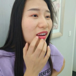 洛阳友好口腔医院医生李新然做牙贴面怎么样？附案例效果图