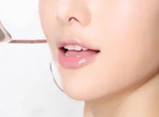 郑州致美士整形医院假体隆下巴
