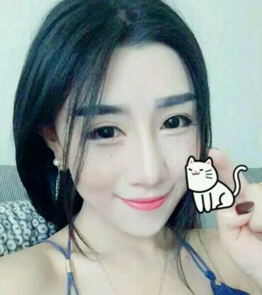 贵阳泰康乐医院整形美容科医生陈璐做自体脂肪全脸填充效果怎么样？