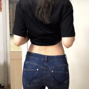 北京可思美整形医院医生斯勤做腰腹吸脂怎么样？附案例效果对比图