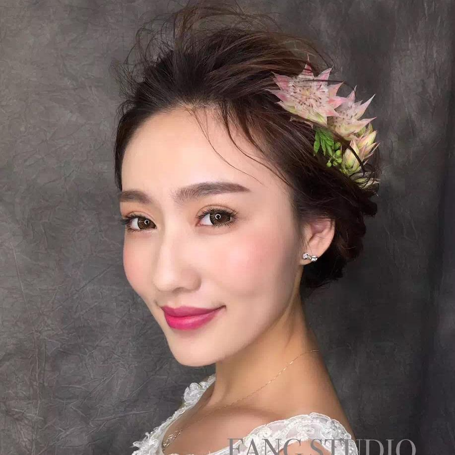 贵阳美和谐医疗整形医生孙泽芳做切开双眼皮效果怎么样？附案例效果对比图