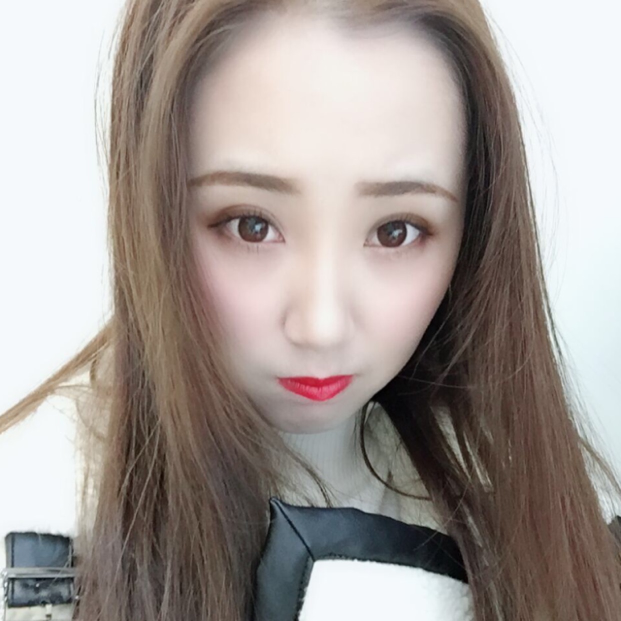 贵阳艺龄医疗美容门诊部医生李章做隆鼻手术怎么样？附案例效果对比图