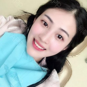 上海科瓦口腔医院医生邓建儒做牙齿冷光美白怎么样？附案例效果对比图
