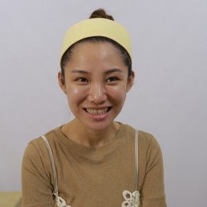 保定东阳口腔医院医生白小青做牙齿冷光美白怎么样？附案例效果对比图