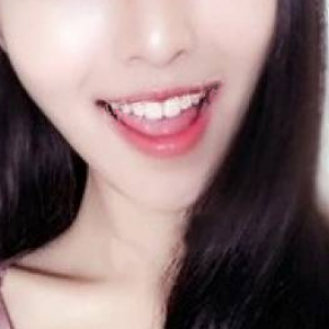 北京美年口腔医院医生刘海涛做牙齿冷光美白怎么样？附案例效果对比图