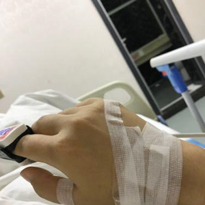 河南协和医院整形外科医生腾利做自体脂肪隆胸怎么样？附案例效果对比图