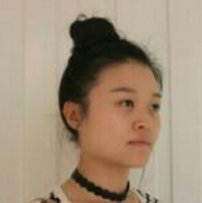 郑州管城中医院整形美容中心医生张秀英做注射瘦脸怎么样？附除皱瘦脸案例效果图