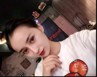 武汉米兰医疗美容医生柳再亿做眼综合+鼻综合整形怎么样？附真实案例对比图