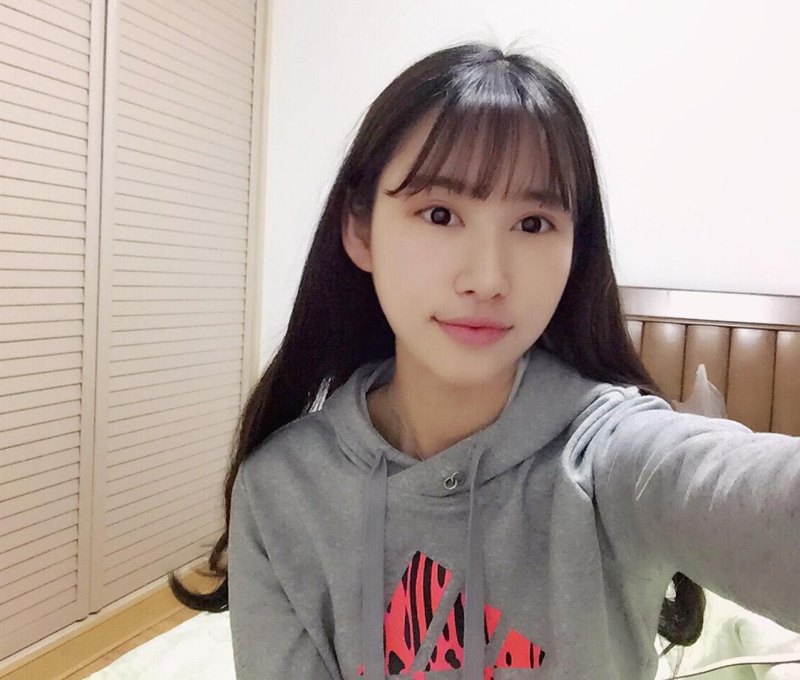 海南华美医学美容医院医生潘磊做颧骨颧弓整形怎么样？附案例效果对比图