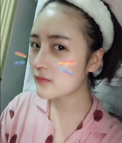 北京伊美尔美容爱康医院医生柳成做鼻综合整形怎么样？附案例效果图