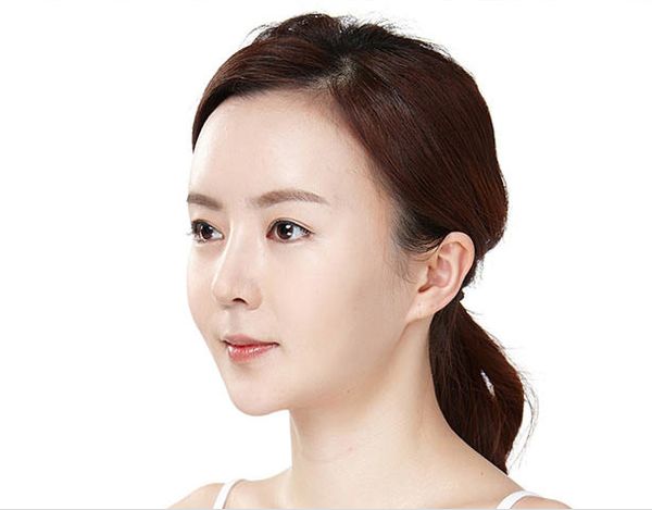 广州鸿业医学美容门诊部下颌角整形