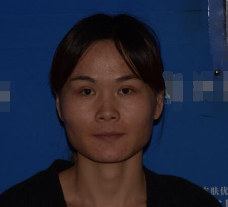 上海时光整形医生何晋龙做下颌角磨骨术前术后案例效果对比图