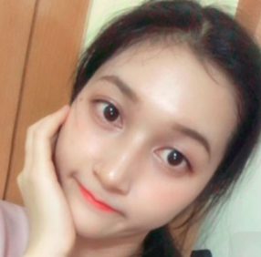 上海时光整形医院做面部玻尿酸注射效果怎么样？