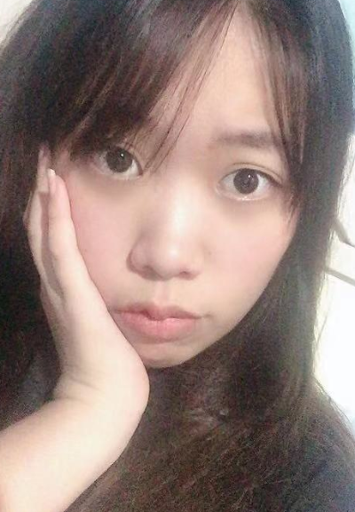 合肥韩美整形美容医院做去眼袋效果怎么样?附金寿信医生去眼袋案例效果图