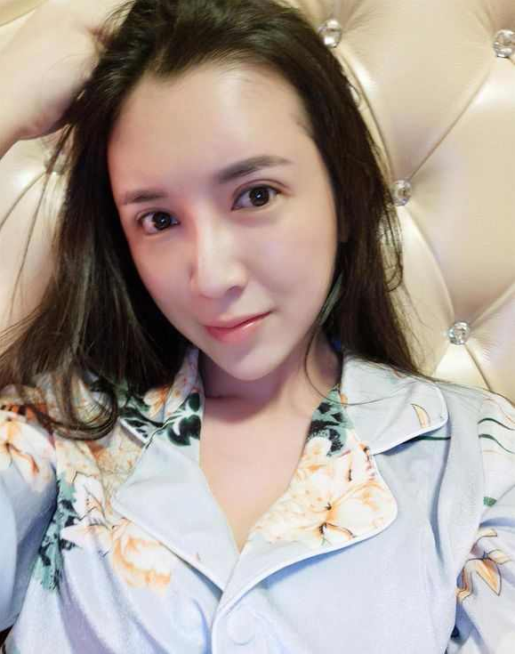上海时光整形医院张晶医生做开眼角怎么样？附真实效果图