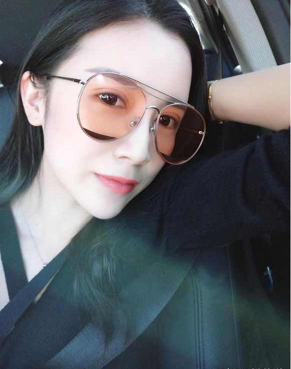 上海时光整形医院张晶医生做开眼角怎么样？附真实效果图