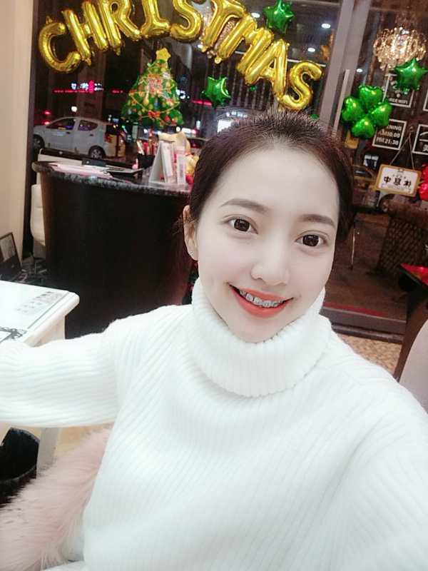 巴中华医口腔医院做牙齿矫正效果好吗？附母汶灵医生牙齿矫正案例效果图