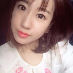 蚌埠韩美美莱整形做玻尿酸面部除皱效果怎么样？附陈泽医生案例效果图