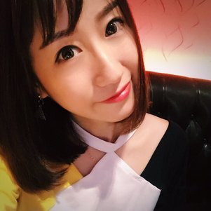 蚌埠韩美美莱整形做玻尿酸面部除皱效果怎么样？附陈泽医生案例效果图