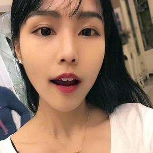 鞍山时代口腔门诊部洗牙效果怎么样？附申元休医生洗牙案例效果图