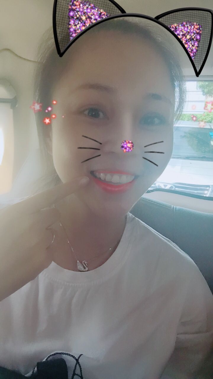 保定东阳口腔医院赵星医生做牙齿瓷贴面怎么样?附牙齿瓷贴面案例效果对比图