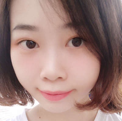 保定安卓贝拉医疗美容门诊部孙大山医生做双眼皮+去眼袋怎么样？附案例效果对比图