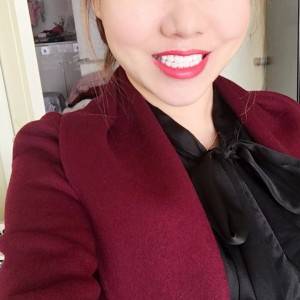 保定东阳口腔医院赵晨医生做瓷贴面怎么样?附瓷贴面案例效果对比图