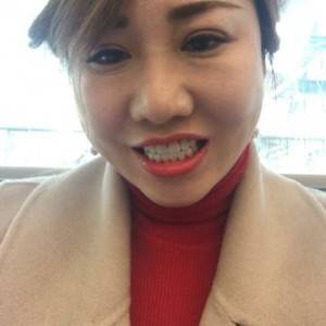 保定东阳口腔医院赵晨医生做瓷贴面怎么样?附瓷贴面案例效果对比图
