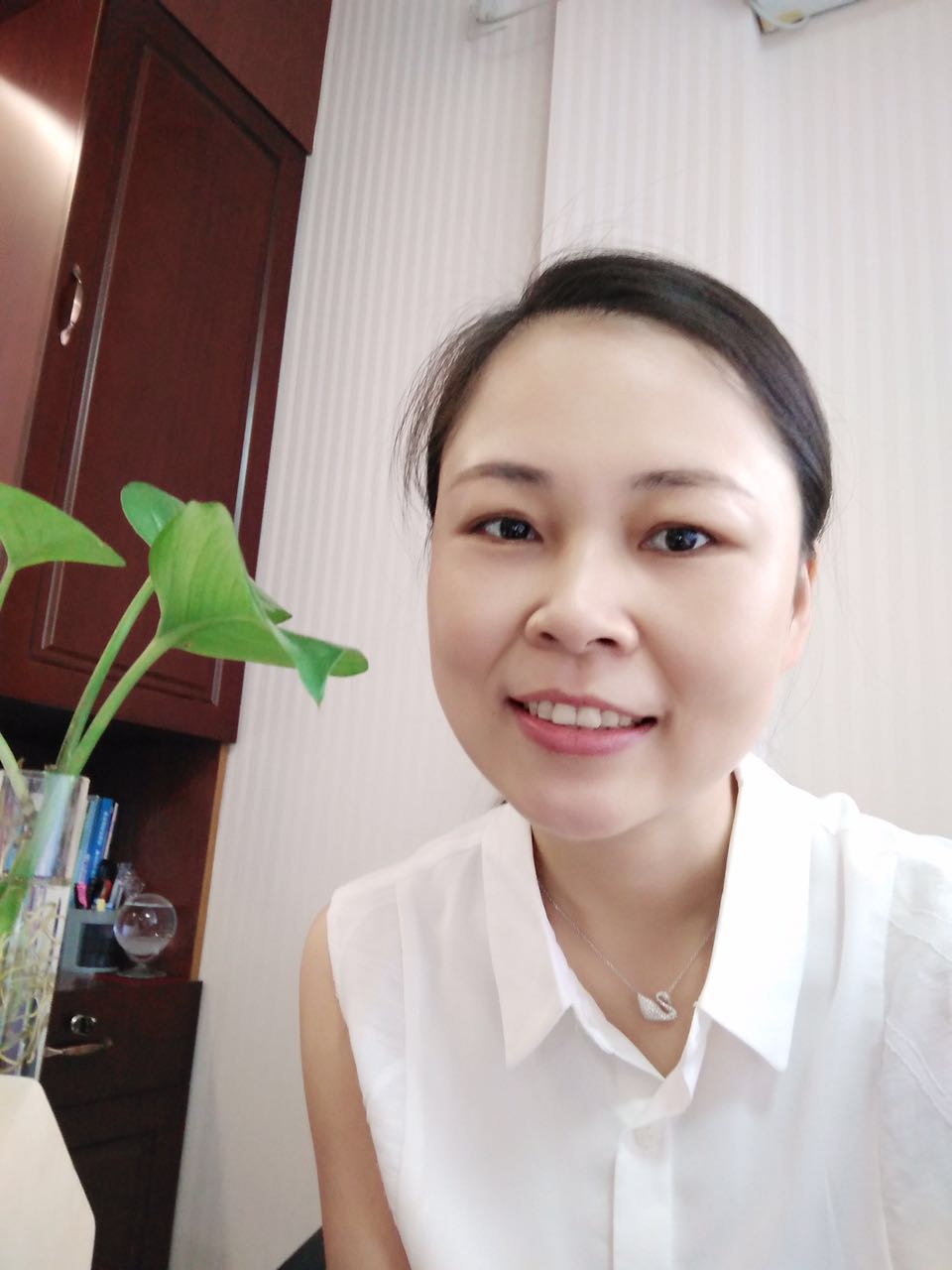 保定东阳口腔医院赵星医生做牙齿瓷贴面怎么样?附牙齿瓷贴面案例效果对比图
