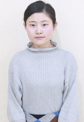 苏州爱思特医疗美容医院下颌角整形手术前效果