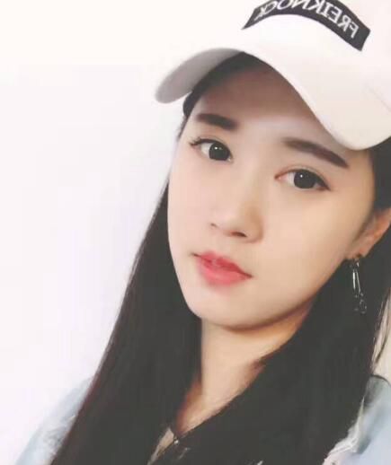 苏州爱思特医疗美容医院双眼皮术后效果