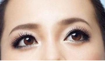 激光去黑眼圈多少钱？激光去黑眼圈效果好吗？