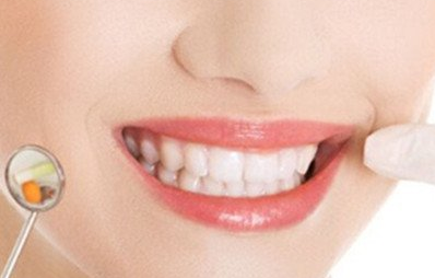 美容冠矫正是什么意思？