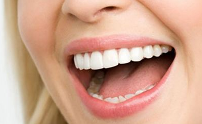 激光美白牙齿能维持多久？术后维持时间长吗？