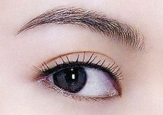 开内眼角的恢复期是多久？