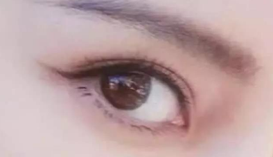 开眼角多久可以完全恢复？