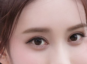 开眼角一般需要多少钱？