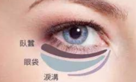 激光能祛除眼袋吗？