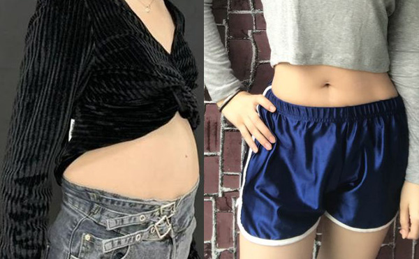 360度环吸抽脂多少钱?效果怎么样?