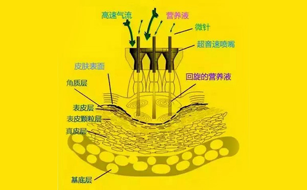  无针水光针是怎么做的?效果怎么样?