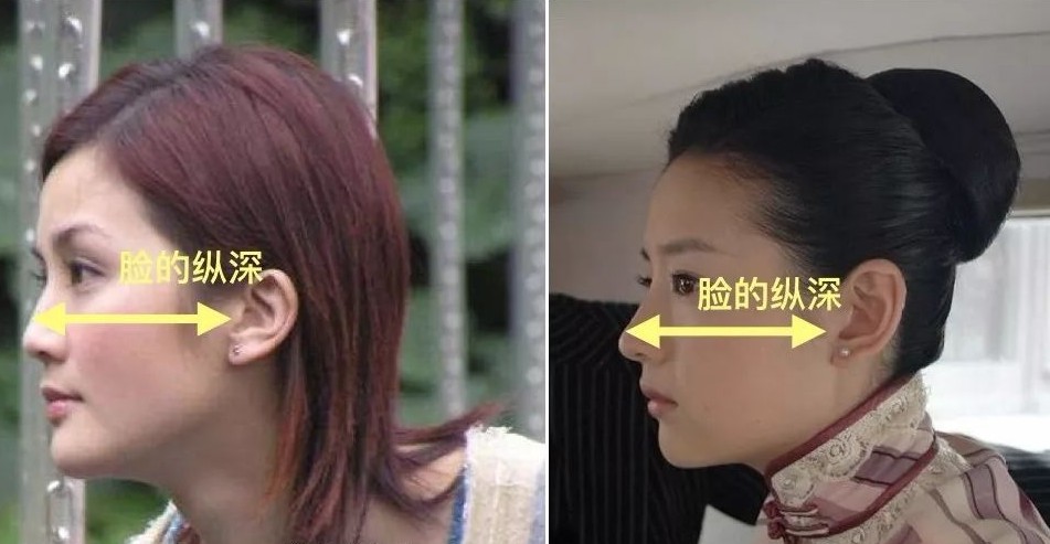 高颧骨对比
