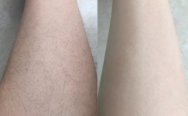 冰点脱腿毛效果怎么样？