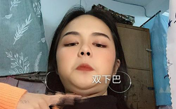 吸脂去双下巴和溶脂瘦下巴有什么区别？