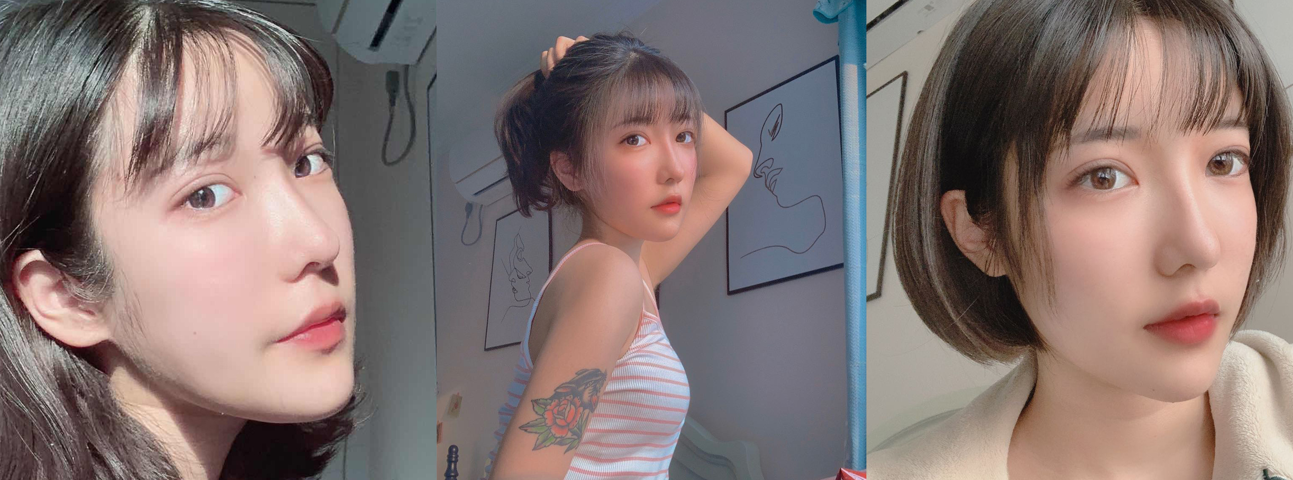杭州时光自体脂肪填充效果图2