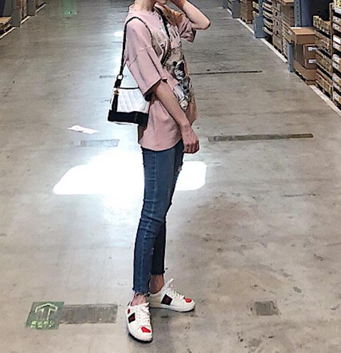 大腿吸脂术后效果反馈