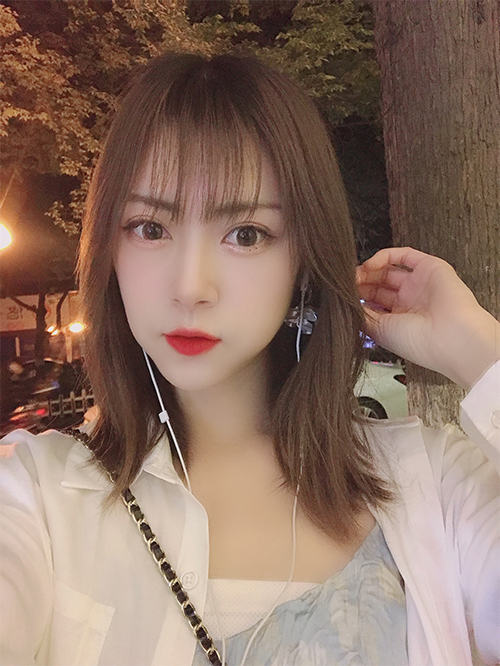 天津伊美尔超肋鼻综合案例两个月后效果图
