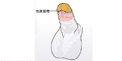 切包皮术后