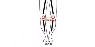 膝内翻矫正术前