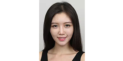 玻尿酸丰苹果肌术后